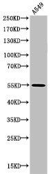 Western Blot analysis of MOUSE-BRAIN cells using Acetyl-NFκB-p65 (K218) Polyclonal Antibody