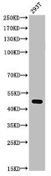 Western Blot analysis of 293T cells using Acetyl-p53 (K372) Polyclonal Antibody