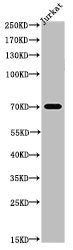 Western Blot analysis of JK cells using Acetyl-p73 (K327) Polyclonal Antibody