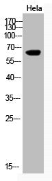 Western Blot analysis of Hela cells using Acetyl-Cytokeratin-pan (K194) Polyclonal Antibody