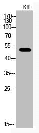 Western Blot analysis of KB cells using Acetyl-p53 (K373) Polyclonal Antibody
