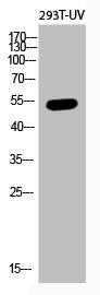 Western Blot analysis of 293T-UV cells using Acetyl-p53 (K382) Polyclonal Antibody