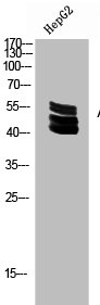 Western Blot analysis of HEPG2 cells using Acetyl-Ub (K27) Polyclonal Antibody