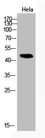 Western Blot analysis of Hela cells using Acetyl-NFκB-p65 (K314/K315) Polyclonal Antibody