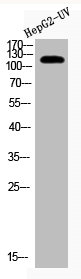 Western Blot analysis of HEPG2-UV cells using Acetyl-CRM1 (K568) Polyclonal Antibody