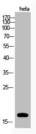 Western Blot analysis of hela cells using Acetyl-Histone H3 (K123) Polyclonal Antibody