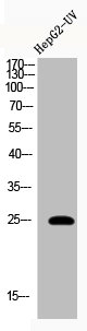 Western Blot analysis of HEPG2-UV cells using Acetyl-HMG-1 (K12) Polyclonal Antibody
