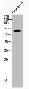 Western Blot analysis of HEPG2-UV cells using Acetyl-NFκB-p65 (K221) Polyclonal Antibody