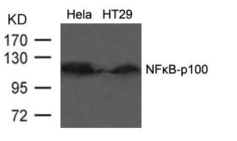 Western blot analysis of extracts from HT29 cells using NFkB-p100(Ab-866) Antibody.