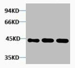 Western blot analysis of 1) Hela, 2) 3T3, 3) Rat Kidney tissue, diluted at 1:5000.