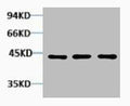Western blot analysis of 1) Hela, 2) 3T3, 3) Rat Kidney tissue, diluted at 1:2000.