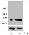 Western blot analysis of extracts from Hela cells, untreated (-) or treated, 1:2000.