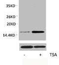 Western blot analysis of extracts from Hela cells, untreated (-) or treated, 1:2000.