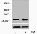 Western blot analysis of extracts from Hela cells, untreated (-) or treated, 1:2000.