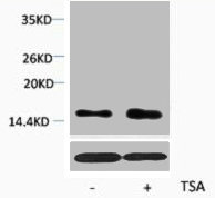 Western blot analysis of extracts from Hela cells, untreated (-) or treated, 1:2000.