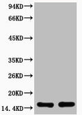 Western blot analysis of extracts from Hela cells, untreated (-) or treated, 1:2000.