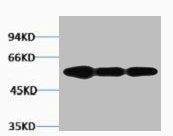 Western blot analysis of 1) Hela, 2) Mouse Brain, 3) Rat Brain tissue, diluted at 1:2000.
