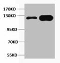Western blot analysis of 1) Mouse Liver, 2) Rat Liver tissue, diluted at 1:2000.