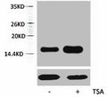 Western blot analysis of extracts from Hela cells, untreated (-) or treated, 1:5000.