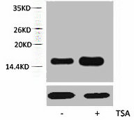 Western blot analysis of extracts from Hela cells, untreated (-) or treated, 1:5000.