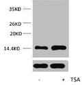 Western blot analysis of extracts from Hela cells, untreated (-) or treated, 1:5000.