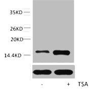 Western blot analysis of extracts from Hela cells, untreated (-) or treated, 1:5000.