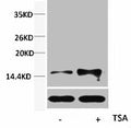Western blot analysis of extracts from Hela cells, untreated (-) or treated, 1:5000.