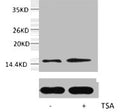 Western blot analysis of extracts from Hela cells, untreated (-) or treated, 1:5000.