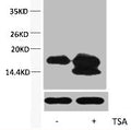 Western blot analysis of extracts from Hela cells, untreated (-) or treated, 1:5000.