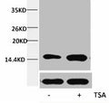 Western blot analysis of extracts from Hela cells, untreated (-) or treated, 1:5000.