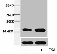 Western blot analysis of extracts from Hela cells, untreated (-) or treated, 1:5000.