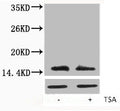 Western blot analysis of extracts from Hela cells, untreated (-) or treated, 1:5000.