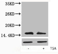 Western blot analysis of extracts from Hela cells, untreated (-) or treated, 1:5000.