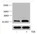 Western blot analysis of extracts from Hela cells, untreated (-) or treated, 1:5000.