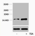 Western blot analysis of extracts from Hela cells, untreated (-) or treated, 1:5000.