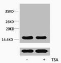 Western blot analysis of extracts from Hela cells, untreated (-) or treated, 1:5000.