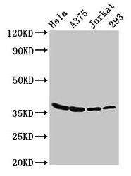 Western Blot
Positive WB detected in: Hela whole cell lysate, A375 whole cell lysate, Jurkat whole cell lysate, 293 whole cell lysate
All lanes: LDHA antibody at 3µg/ml
Secondary
Goat polyclonal to rabbit IgG at 1/50000 dilution
Predicted band size: 37, 31, 40, 27 kDa
Observed band size: 37 kDa