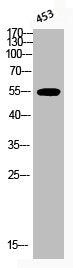 Phospho-AKT1 (T450) Antibody – Figure 1 of 3
