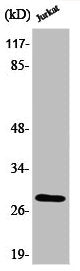 Western Blot analysis of Jurkat cells using Phospho-Bcl-2 (T56) Polyclonal Antibody