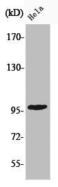Phospho-CHEK2 (T68) Antibody – Figure 1 of 2