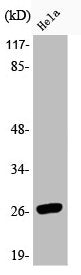 Western Blot analysis of HeLa cells using Phospho-HSP27 (S78) Polyclonal Antibody