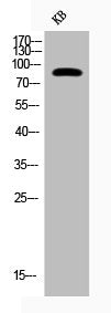 Phospho-CHUK (T23) Antibody – Figure 1 of 2