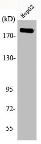 Western Blot analysis of HepG2 cells using Phospho-IRS-1 (S1101) Polyclonal Antibody