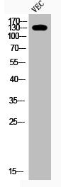 Western Blot analysis of VEC cells using Phospho-IRS-1 (S307) Polyclonal Antibody
