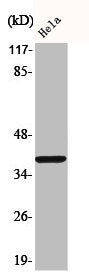 Western Blot analysis of HeLa cells using Phospho-MEK-3 (S218) Polyclonal Antibody