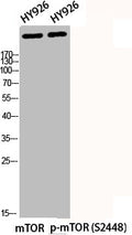 Phospho-MTOR (S2448) Antibody – Figure 1 of 2