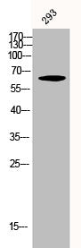 Western Blot analysis of 293 cells using Phospho-NFκB-p65 (S276) Polyclonal Antibody