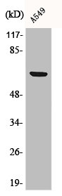 Phospho-RPS6KB1 (S447) Antibody – Figure 1 of 1