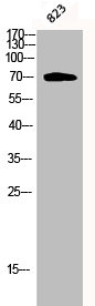 Phospho-PRKCZ (T410) Antibody – Figure 1 of 2