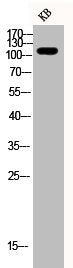Western Blot analysis of KB cells using Phospho-Rb (S780) Polyclonal Antibody